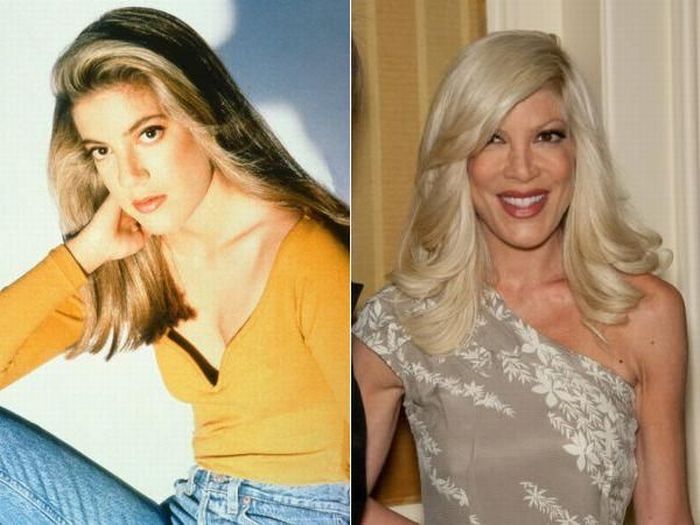 Beverly Hills 90210. Then and Now  (13 pics)