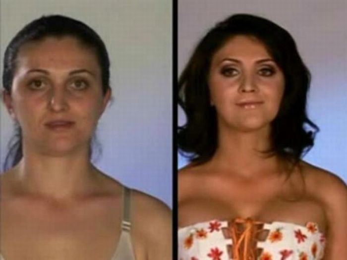 anna faris plastic surgery before after. efore surgery. Romanian