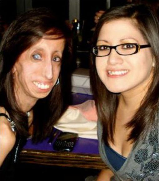 The Story of 21-year-old Lizzie Velasquez (17 pics)