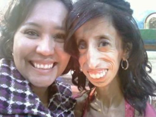 The Story of 21-year-old Lizzie Velasquez (17 pics)