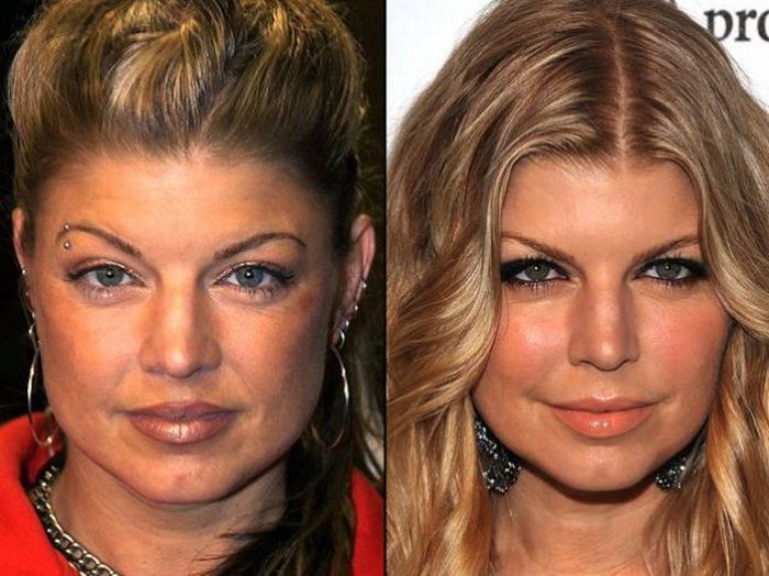 celebrities before and after plastic surgery