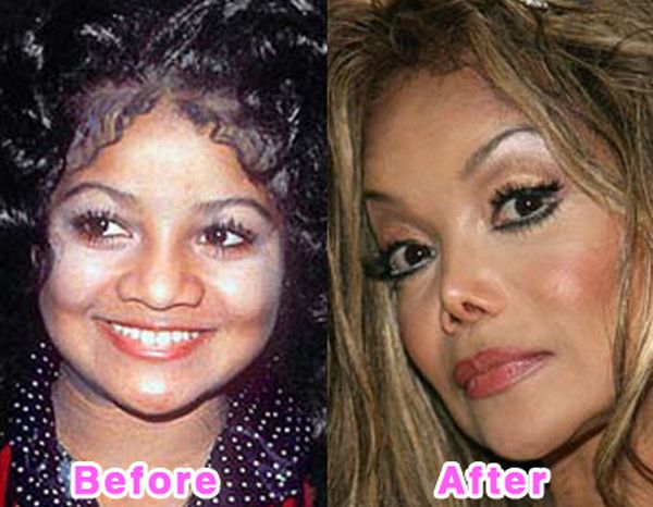 Plastic Surgery Disasters.