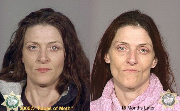 Faces of Meth. Part 2 (38 pics)