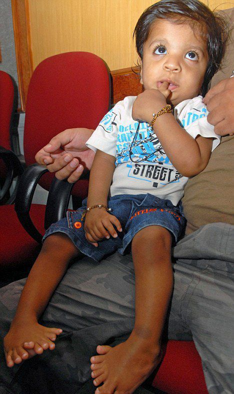 OMG! Indian Boy Born With 34 Fingers (4 pics)