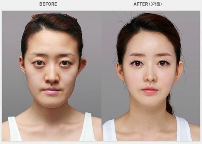 Korean Plastic Surgery (31 pics)