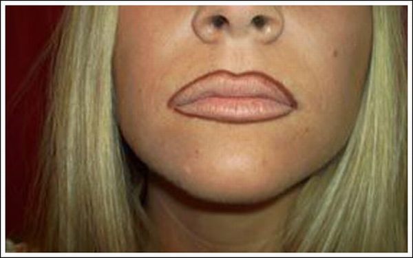 How To Enlarge Your Lips 10 Pics-5284